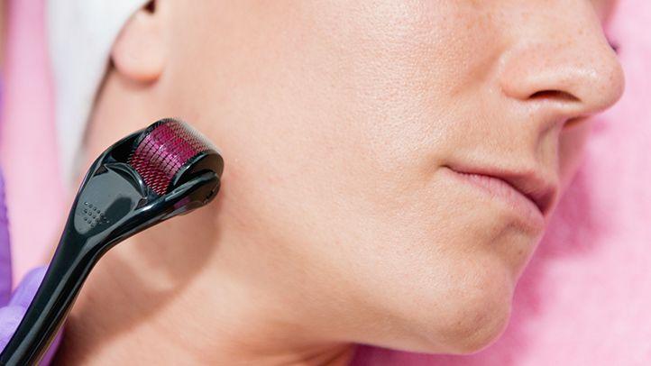 Derma Roller – Anti-Aging, Scar Removal, Facial Scrub